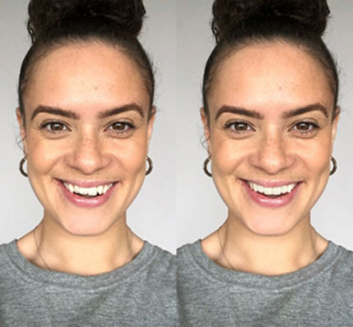 Smiling after teeth whitening at Pinner Green Dental
