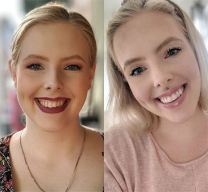 Smiling after teeth whitening at Pinner Green Dental