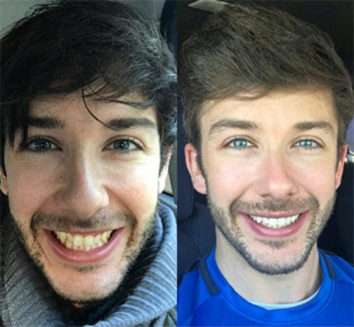 Pinner Green Dental patient showing perfect teeth