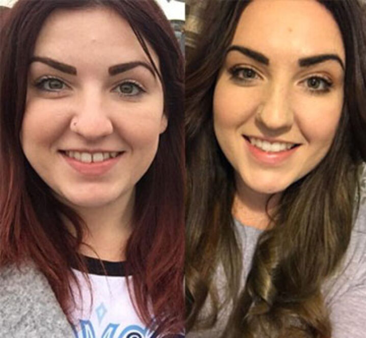 Pinner Green Dental patient showing perfect teeth