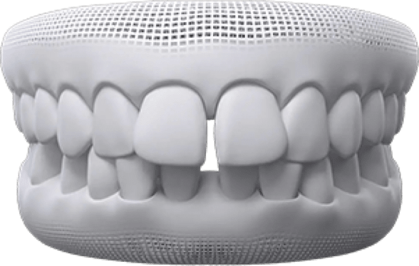 Teeth whitening treatment at Pinner Green Dental