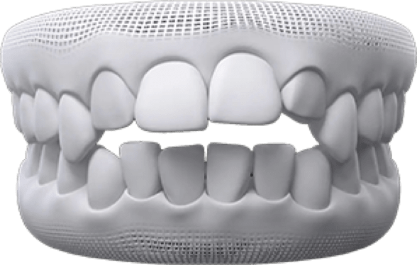Teeth whitening treatment at Pinner Green Dental