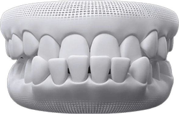 Teeth whitening treatment at Pinner Green Dental
