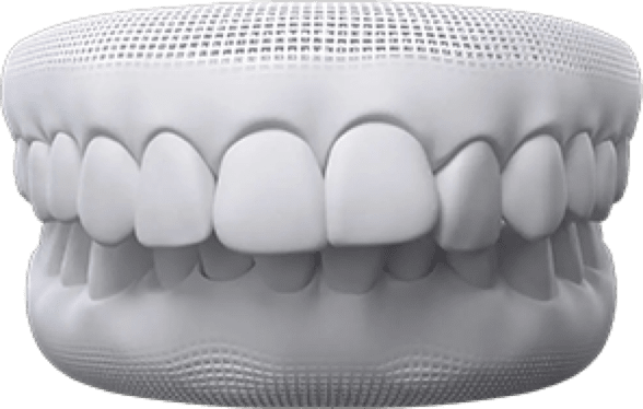 Teeth whitening treatment at Pinner Green Dental