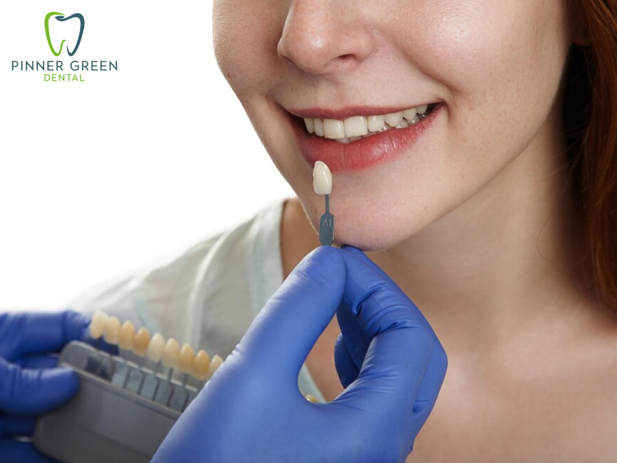 dental implant